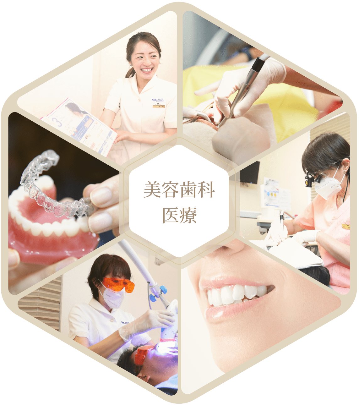 美容歯科医療メニュー